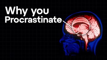 The Neuro-science of Procrastination & How To Fix It