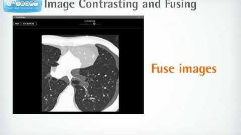 PACS - Picture Archiving Communication System Software