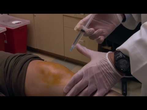 Prolotherapy Performed On The Knee by Dr. Marc Dar...