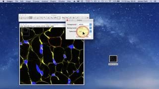 Using ImageJ to measure cell number and cross-sectional area of confocal images Using ImageJ to measure cell number and cross-sectional area of confocal images