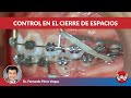 Tips para el cierre de espacios en Ortodoncia