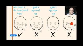 aa303c अम्बु बॅग अशी वापरा शिशू पुनर्जीवन निओनेटल रिससीटेशन 3 14