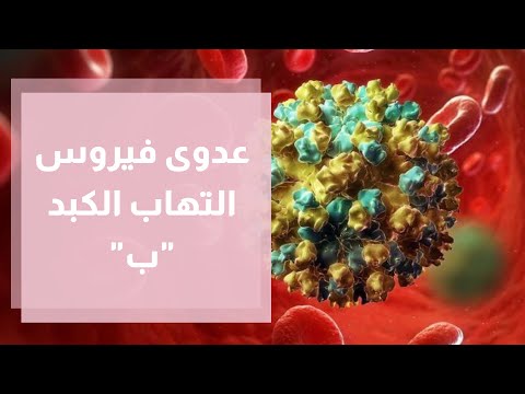 فيروس التهاب الكبد ب الأسباب الأعراض والعلاج