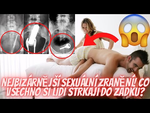 Video: Ako Odstrániť Chyby V Zadku