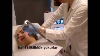 Scarlet Uygulaması