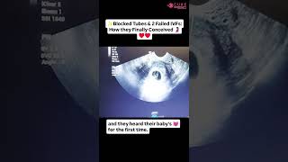 Blocked Tubes &amp; 2 Failed IVFs: How They Finally Conceived! 😍 | ERA Test explained #shorts #ivf