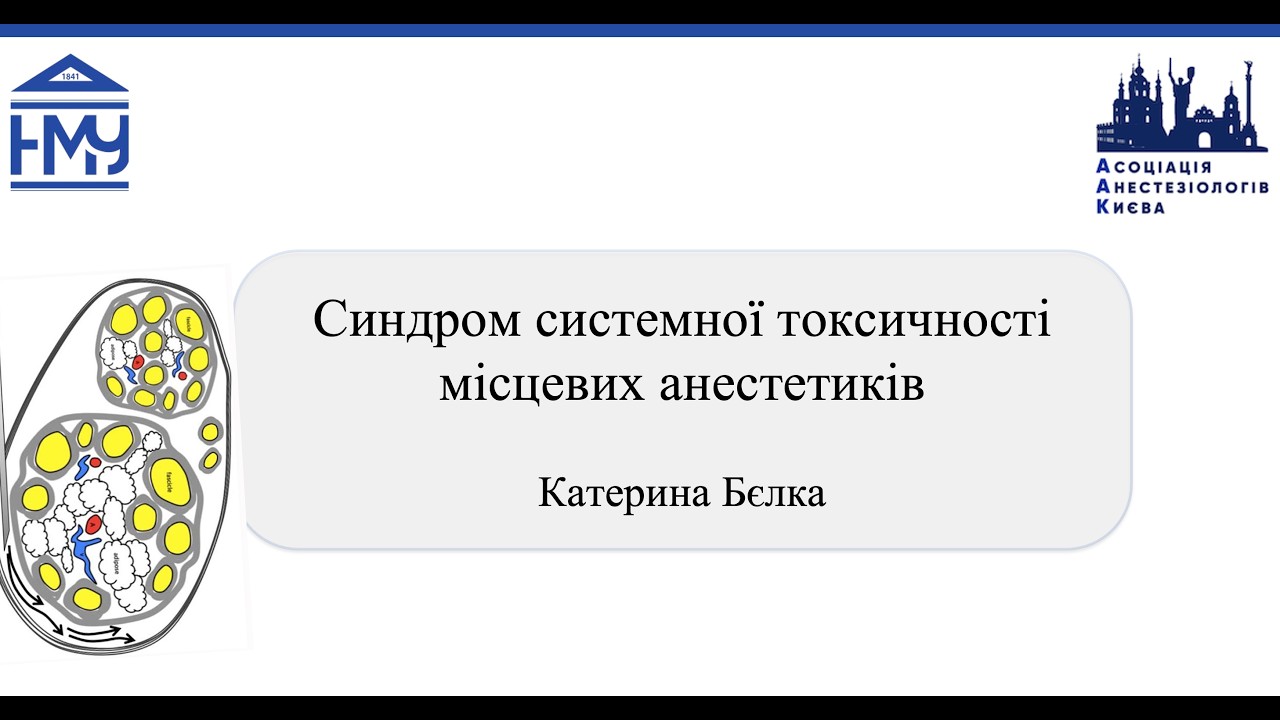 Системна токсичність МА: розпізнавання та лікування.