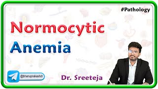 5. Normocytic Anemia | USMLE Step Pathology