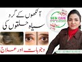 What is reason for dark circle under eyes  ankhon ke gird siyah halke banney ki wajah in urdu