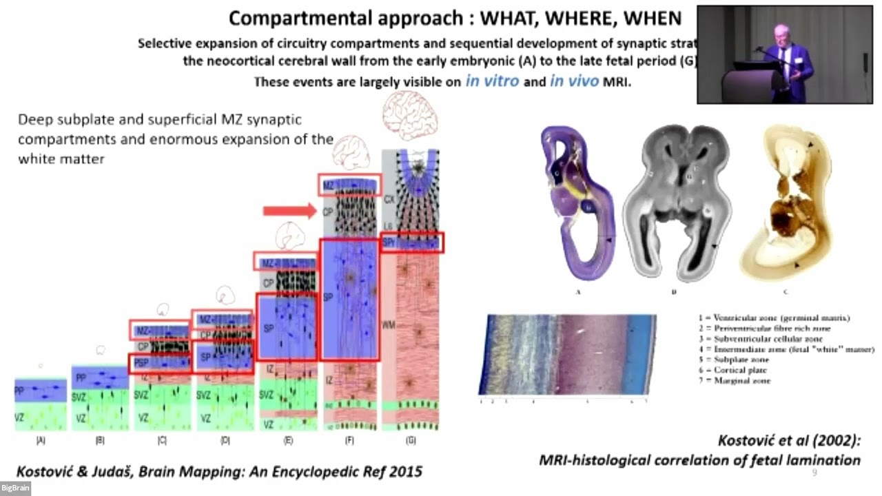 Ivica Kostović: From transient cellular compartments to brain's network architecture