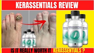 kerassentials reviews-Kerassentials Antifungal-Kerassentials REVIEW