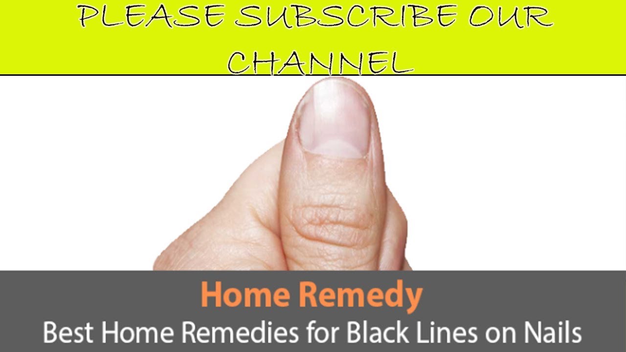Best Home Remedies for Black Lines on Nails Fungus key Treatment V 4