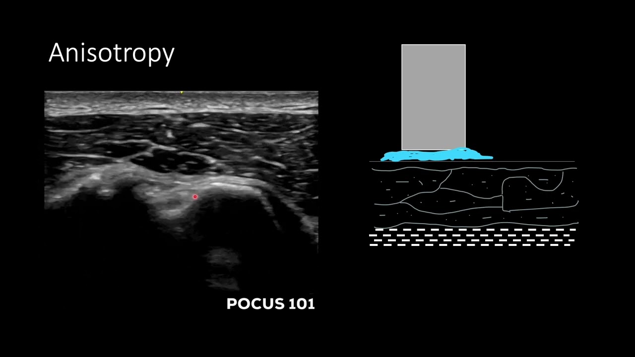 Intro to MSK Ultrasound | Anatomy, Artifacts & Scanning Basics