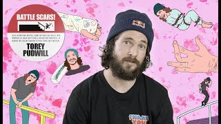 The Worst Injuries Of Torey Pudwill’s Career | Battle Scars