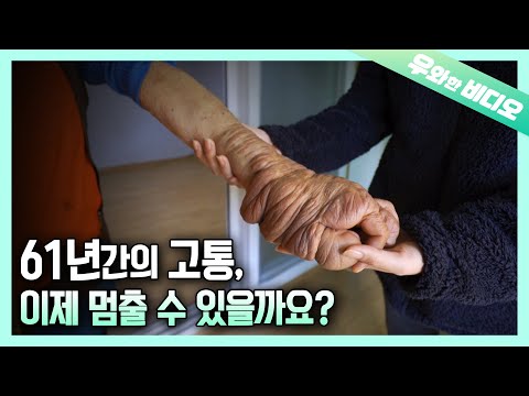 61년간 거대한 혹들에 둘러싸인 풍선 손 여인의 고통 ┃<strong>61</strong> Years of Humongous Tumors.... A Woman <strong>With</strong> Balloon Size Hand