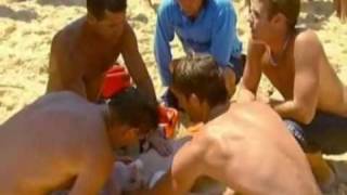 Paragem Cardio-Respiratória Em Bondi Beach