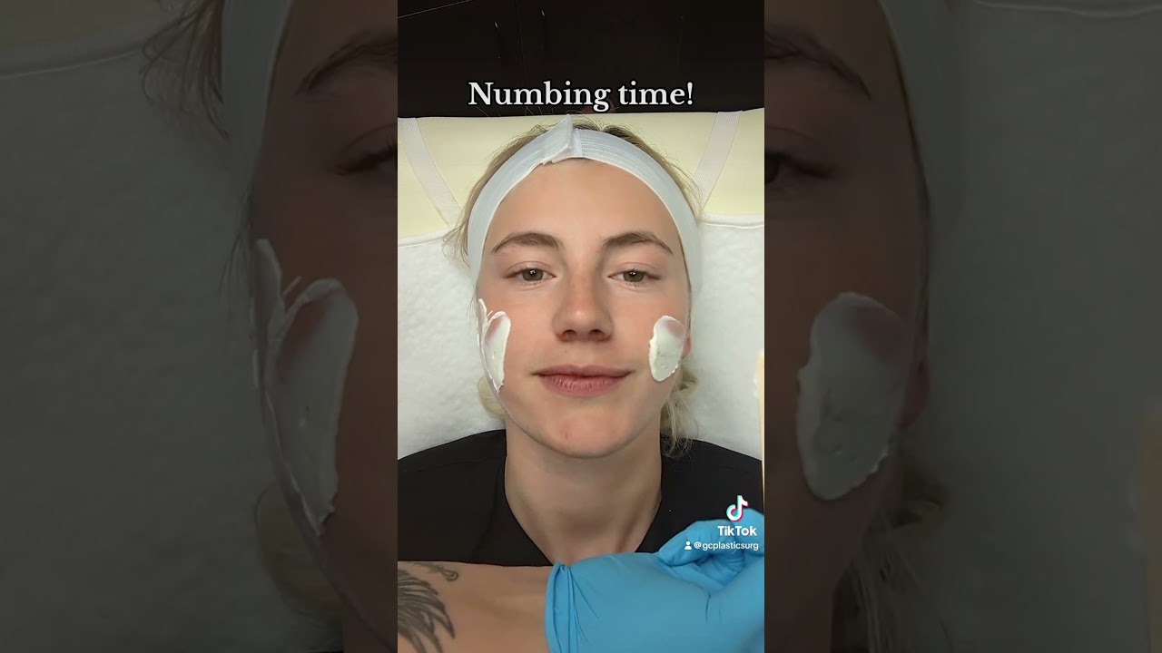 Get Potenza RF Microneedling with Me