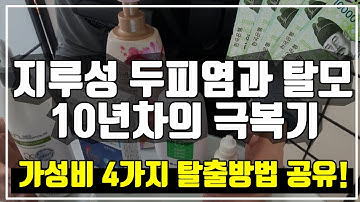 호구되지 않고 지루성 두피염과 탈모를 극복하는 4가지 방법