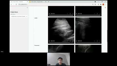 Deep Learning Based Lung Ultrasound Video Classification to Predict COVID