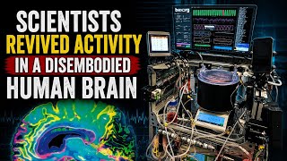 Famous SCIENTISTS REVIVED ACTIVITY IN A DISEMBODIED HUMAN BRAIN Wealth