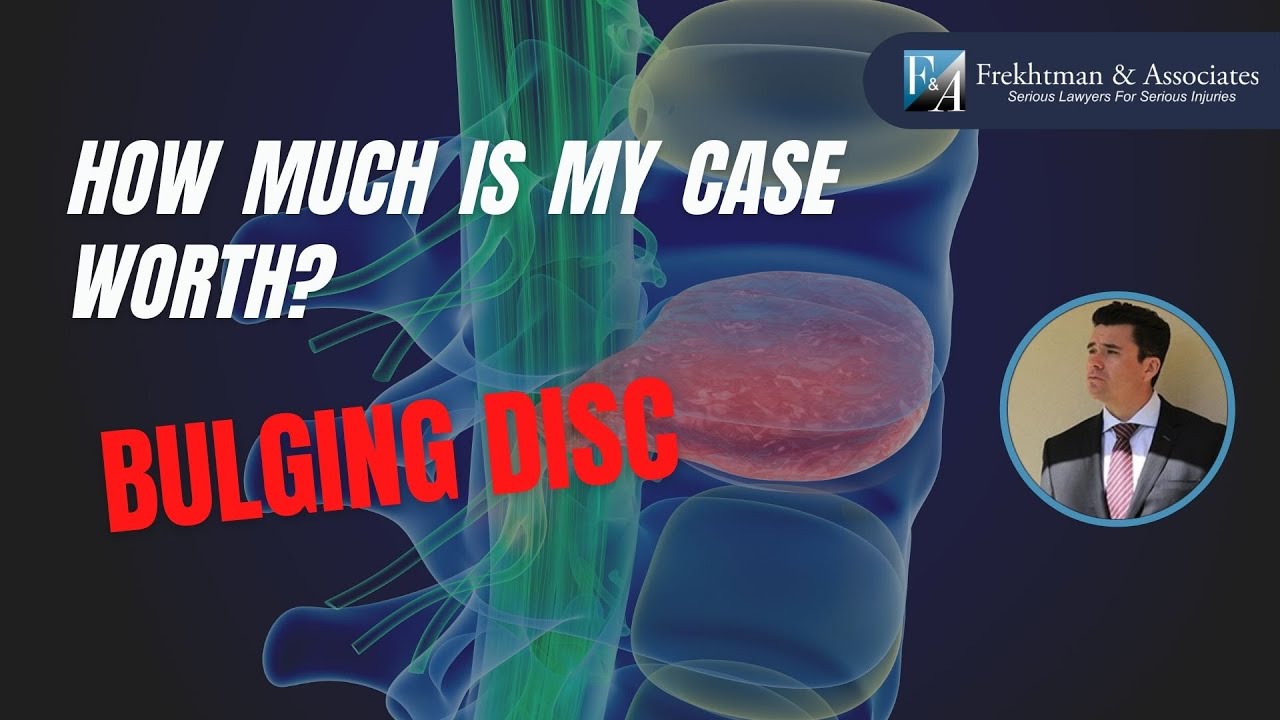 How Much Is A Herniated Disc Worth? What's My Case Worth Series