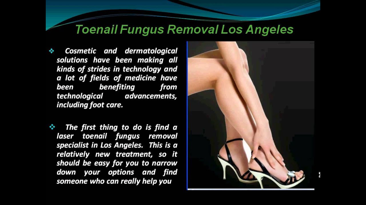 Why You need Laser Toenail Fungus Treatment in Los Angeles? YouTube