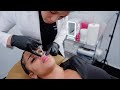 vlog: getting lip filler for the very first time