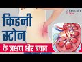        kidney stone early symptoms and prevention in hindi