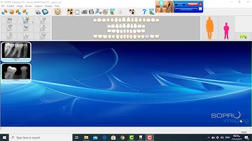 sopix operation disappear