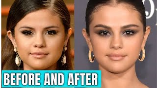 Selena Gomez: Plastic Surgery (2020) & Beauty.