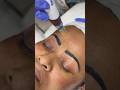 Derma pen 4 treatment #dermapen #treatment #skincare