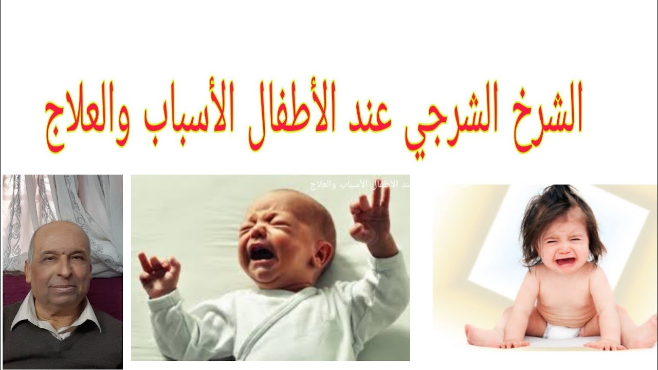 الشرخ الشرجي عند الأطفال الأسباب والعلاج