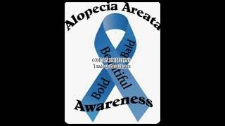Alopecia #Bald #Alopecia #september