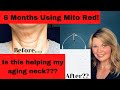 6 Months Using Red Light Therapy! Is this helping my aging neck??? Mito Red Light Pro Review!