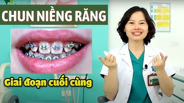 Ý Nghĩa Các Loại Chun Niềng Răng/Chun niềng răng là gì? Bác sĩ Yến Yteeth