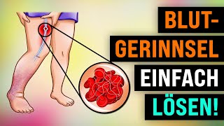 6 Vitamine, die deine Blutgerinnsel AUFLÖSEN