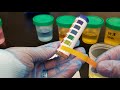 Introduction to Clinical Lab: pH Paper Measurement