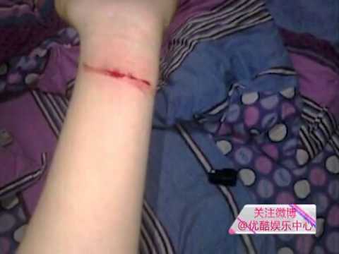 韩星雅安地震日庆生被批偏激粉丝割腕抗议