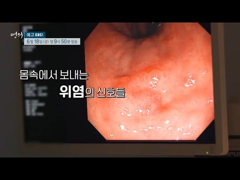 [예고] 명의 -  위염쯤이야...암의 공포를 만든다 만성위염