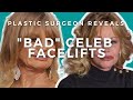 What went wrong with goldie hawn and melanie griffiths facelifts