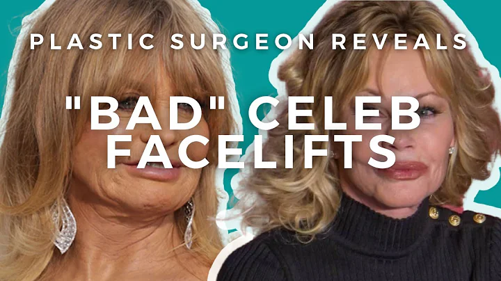 What went wrong with Goldie Hawn and Melanie Griffith's Facelifts?