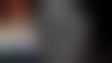 Case 13_ERCP with SpyGlass cholangioscopy for evaluation of left intrahepatic duct stricture