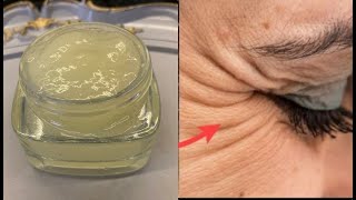 Botoks Etki̇li̇ Göz Çevresi̇ Kremi̇ Kirişikliklari Si̇len Yumurta Aki Kremi̇