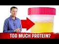 Top 5 Symptoms Of Eating Too Much Protein – Dr.Berg