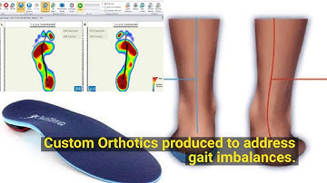 Gaitscan: Physio Drogheda