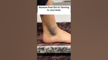 Get Rid Of Dark Ankle |Clean Feet Dirt & Suntan/Very Easy Pedicure,Remove Skin Suntan #shorts #video