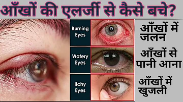 आँखों की Allergy से कैसे बचे?(आँखों में लाली,पानी,खुजली,जलन क्यों होता हैं।How to protect your eye.