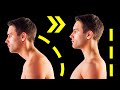How to Fix Your Posture In Just 5 Moves