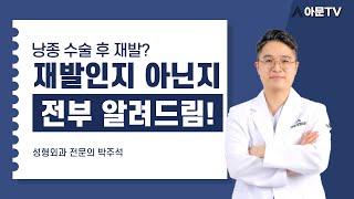 낭종 수술 후 재발인지 의심이 된다면? (낭종 지방종 표피낭종 피지낭종 핀홀법 수술 낭종재발 재발 재발가능성 성형외과 병원 강동 강남 대학병원) [아문TV]