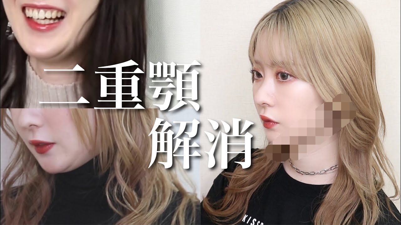小顔 コンプレックスの二重顎をどーにかしたい ハイフ Youtube 小顔 コンプレックスの二重顎をどーにかしたい ハイフ Youtube